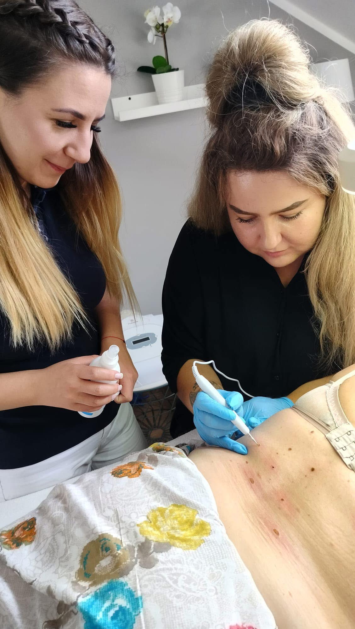 Elektrokoagulacja - stopień 1 - obrazek 5