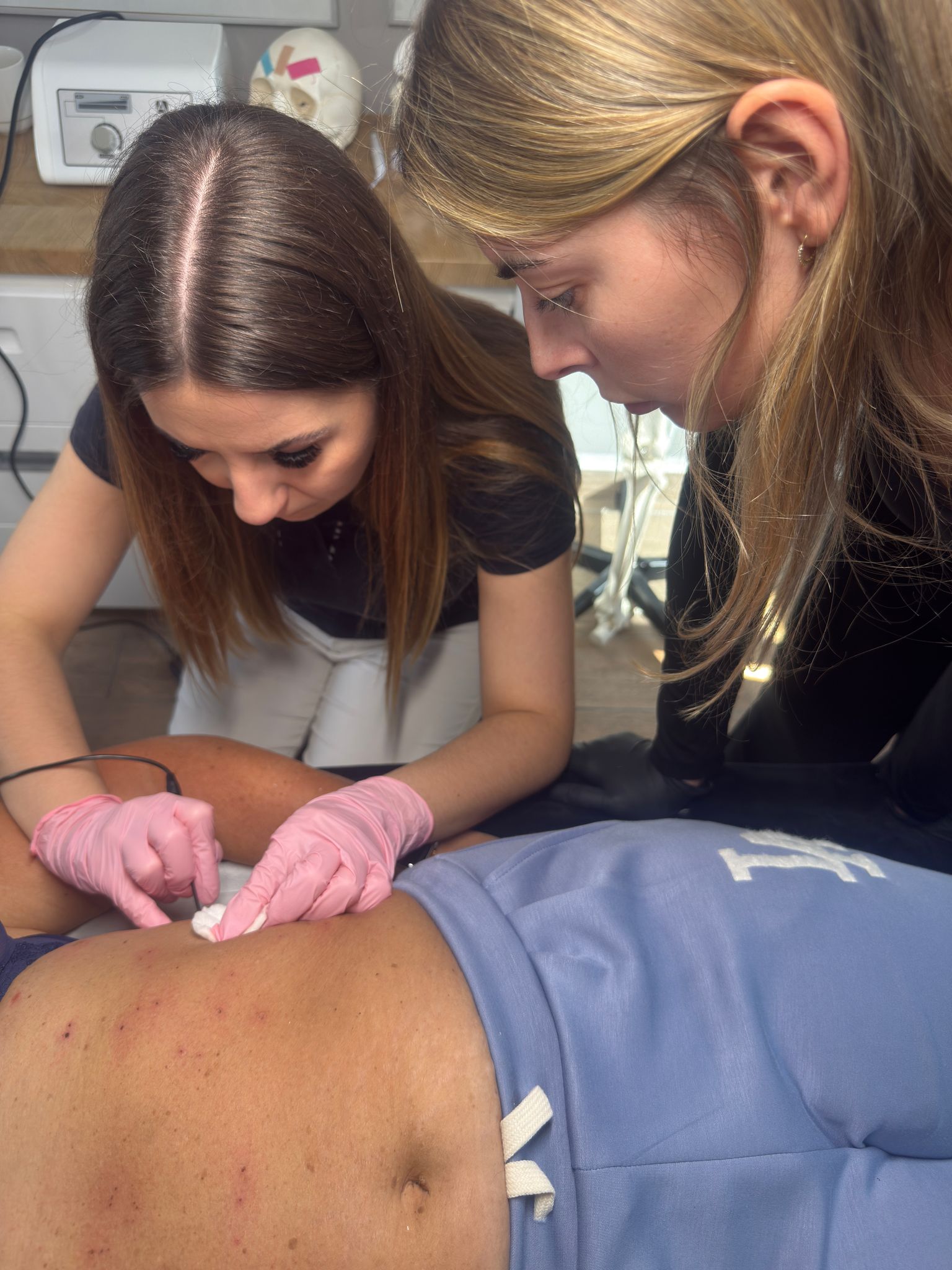 Elektrokoagulacja - stopień 1 + 2 - obrazek 5